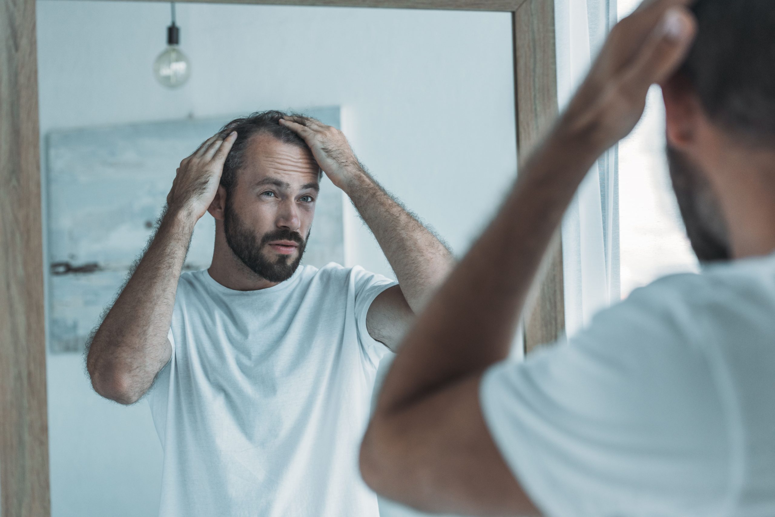 How To Avoid Hair Loss on TRT: Side Effects of Testosterone Replacement Therapy